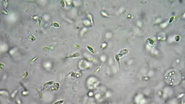 Hombre sano esperma bajo el microscopio — Vídeos de Stock
