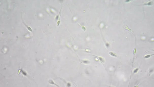 Здоровая сперма под микроскопом — стоковое видео