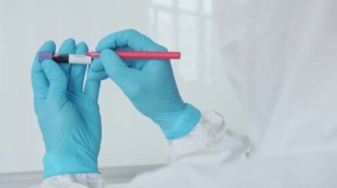 Hastanedeki CV19 muayenesi sırasında test tüpüne kan ve eldiven ile yazılmış ellerin yakın çekimi.