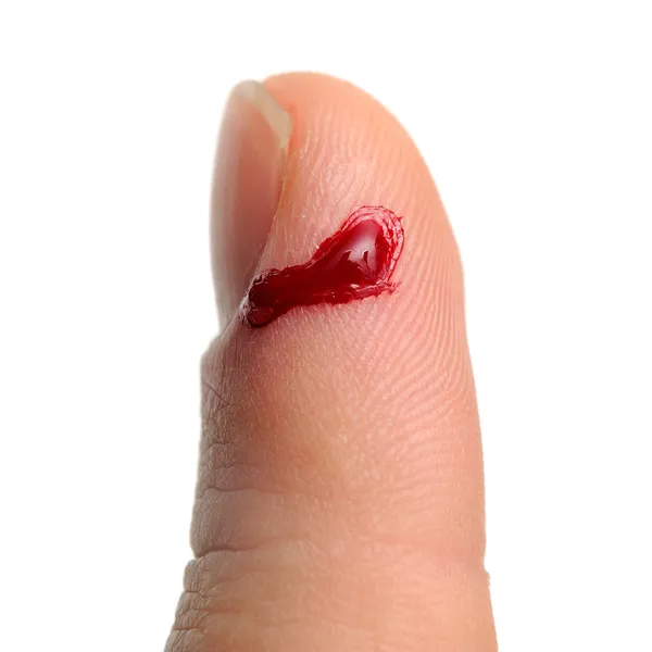 Bloeden uit gesneden vinger — Stockfoto
