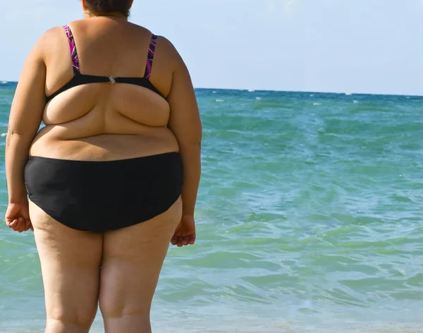 Obesitas vrouwen Stockafbeelding