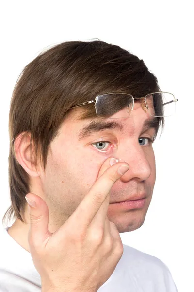 Nahaufnahme des braunen Auges eines Mannes beim Einfügen eines Korrektivs c — Stockfoto