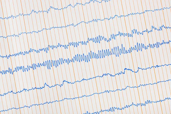 Électrocardiogramme ecg — Photo