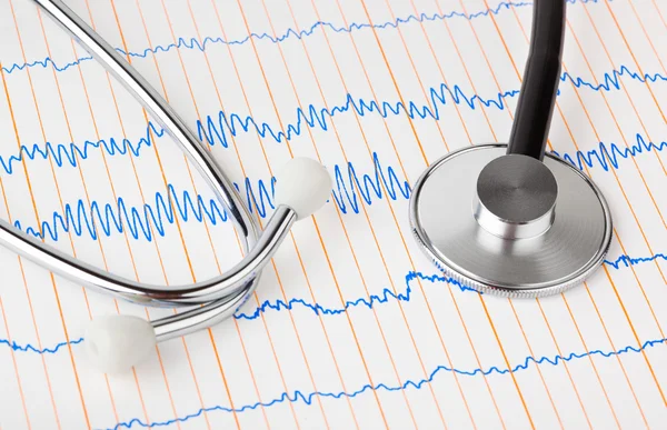 Stethoscope on ecg — Stock Photo, Image