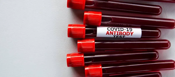 Sok Cső Vérvizsgálat Címkével Covid Antitest Teszt — Stock Fotó