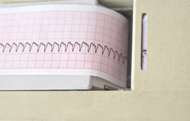 electrocardiograph