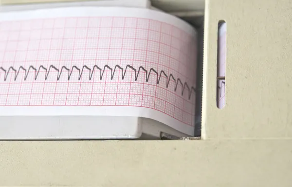 Eletrocardiógrafo — Fotografia de Stock