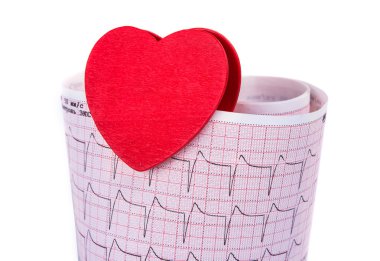 Elektrokardiyogram bir kalp