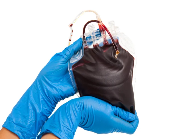 Påse med blod i händerna på en sjuksköterska — Stockfoto