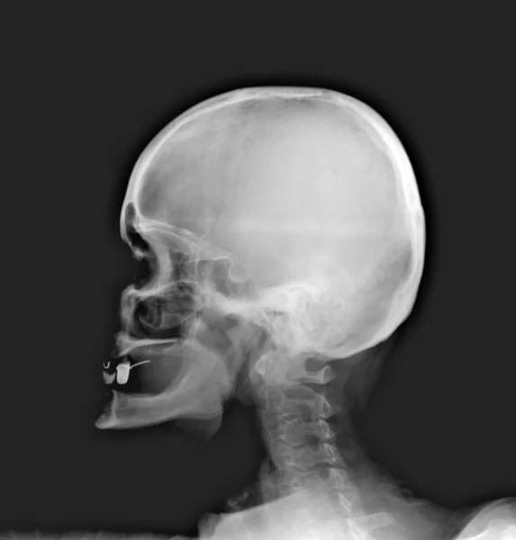 Detalhe da imagem de raio-x de pescoço e cabeça — Fotografia de Stock
