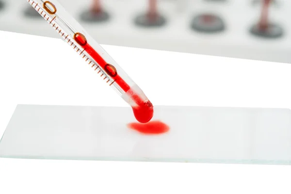 Blood test — Stock Photo, Image