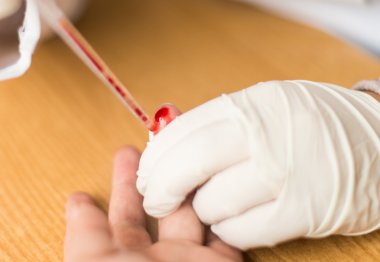 kan analizi Laboratuvarı