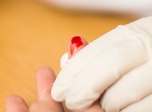 Laboratory analysis of blood — Stock Photo, Image