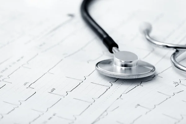 A a cardiogram sztetoszkóp — Stock Fotó