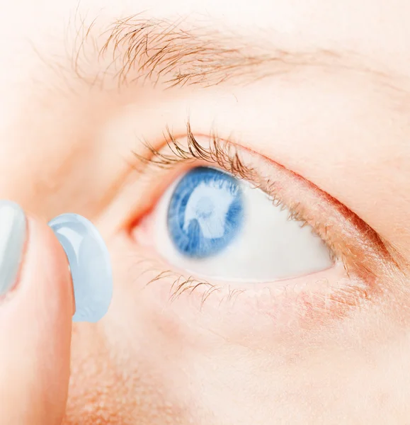 Primer plano de la inserción de una lente de contacto en el ojo femenino — Foto de Stock