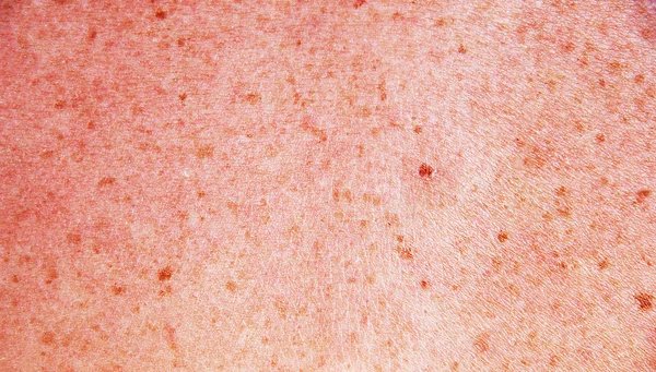 vahşi eski su aygırı derinin yapısı