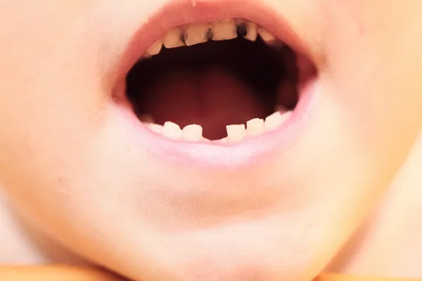Zähne — Stockfoto