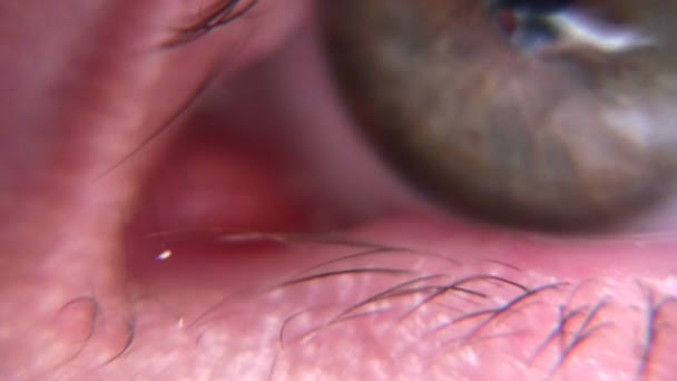 Bolsa lacrimal del ojo humano — Vídeo de stock