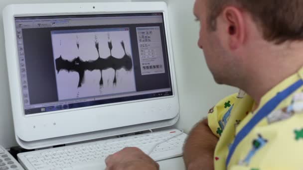 Dentist watch x-ray picture on computer display — Stock Video