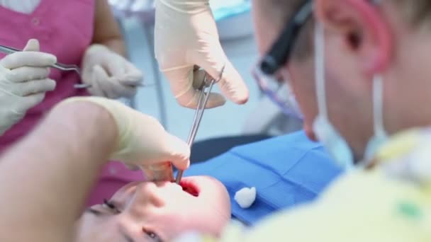 Doutor costura ferida na boca da menina depois de piscinas fora dente — Vídeo de Stock