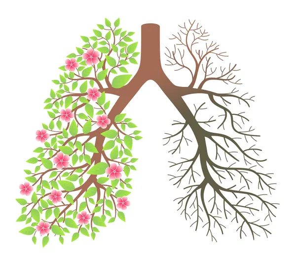 Pulmones. Efecto después del tabaquismo y enfermedad — Vector de stock
