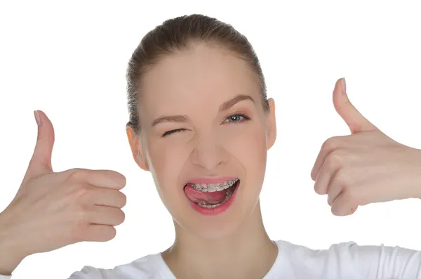 Sorrindo menina feliz com aparelho nos dentes — Fotografia de Stock