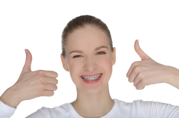 Sorrindo menina feliz com aparelho — Fotografia de Stock