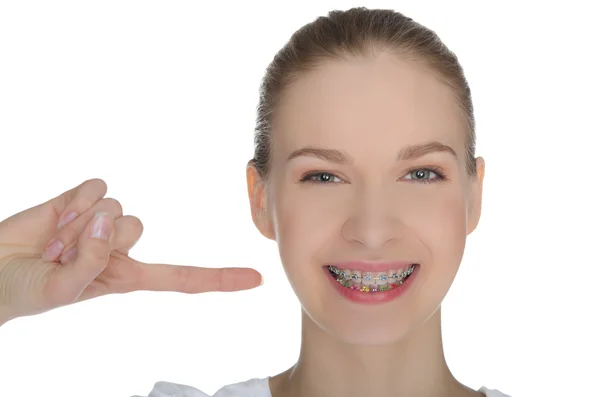 Smiling happy girl indicates braces on teeth — Stock Photo, Image