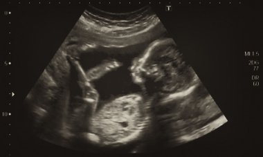 Ultrasonography Analysis of a 4th Month Fetus clipart