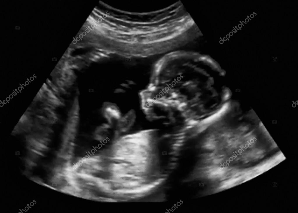 Ultrasonido obstetrico fotografías e imágenes de alta resolución - Alamy