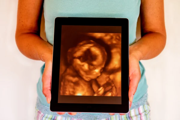 Žena s 3d ultrazvukem — Stock fotografie