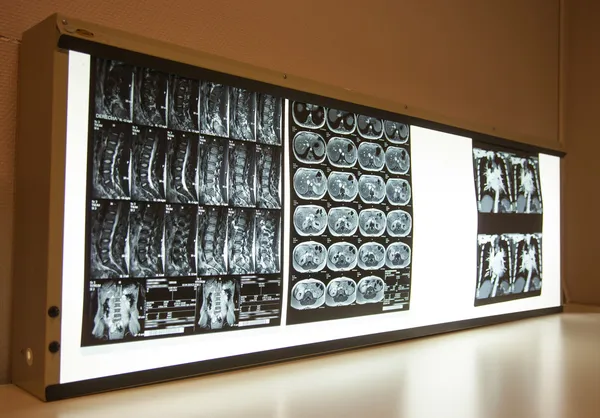 Muur scherm met x-ray scans — Stockfoto