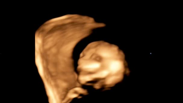 Mozione di ecografia ad ultrasuoni 4D dell'utero materno di un bambino. Concetto di vita, scoperta scientifica — Video Stock