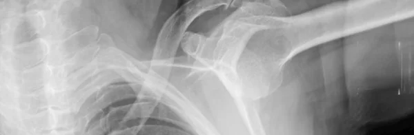 Nsan Göğsü Akciğerleri Röntgen — Stok fotoğraf