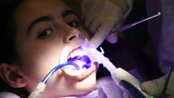 Tandläkare tillämpa tandställning för tänder till en ung flicka i studion — Stockvideo