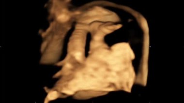 Bebeğin anne karnının 4D ultrason ekografisi. Yaşam konsepti, bilimsel keşif