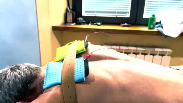 Мышечный стимулятор с электродами, нанесенными на бицепсы и плечи профессиональным физиотерапевтом — стоковое видео