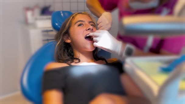 Gros Plan Main Dentiste Mettant Élastique Élastique Élastique Sur Les — Video