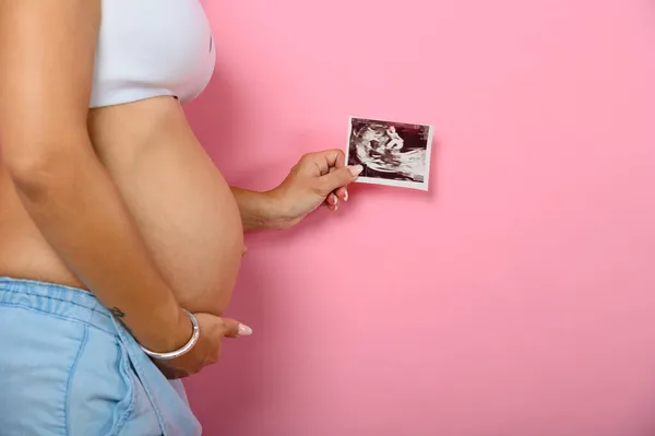 Maman enceinte montre une échographie de son fils — Photo
