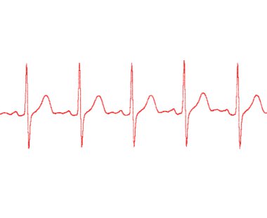 kardiyogram beyaz zemin üzerine