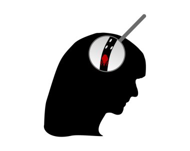 Head of woman, louse and nits clipart