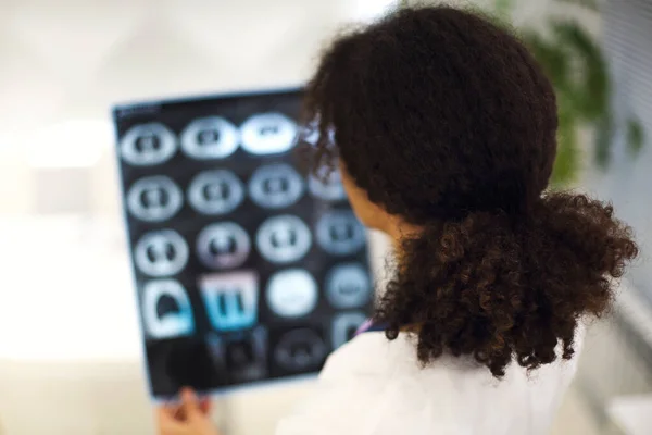 重看少数民族女医生在医院工作时对X光或Mri扫描的分析 有选择的焦点 医生检查Ct扫描 使用诊断工具检测肺部疾病 — 图库照片