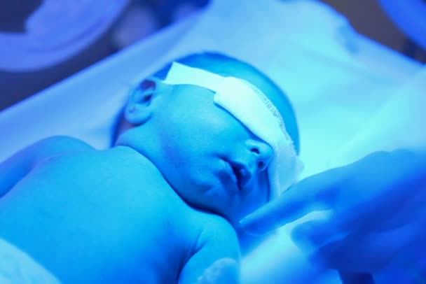 För tidig baby i en inkubator — Stockvideo