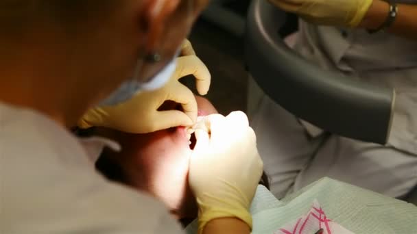 Fogászat. fogászati kezelés — Stock videók