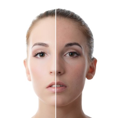 güzel kızın yüzüne sorunları ile