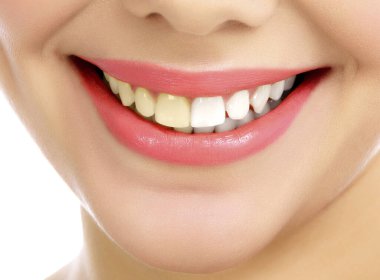 Genç, gülümseyen bir kadın, beyaz arka plan, mekan. Önce ve sonra kavramı