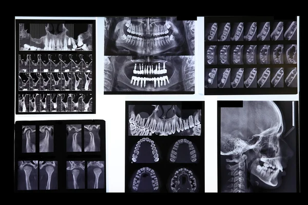 X-ray 3D-afbeelding — Stockfoto