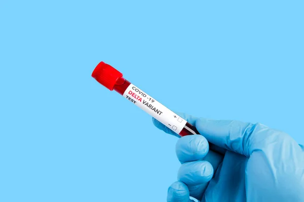 Analisi Del Sangue Con Etichetta Covid Delta Variant — Foto Stock