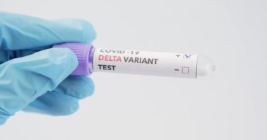 Covid-19 DELTA Varyantı etiketli kan testi.