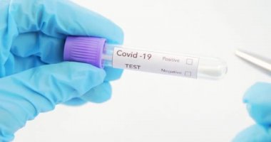 Covid-19 DELTA Varyantı etiketli kan testi.